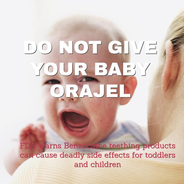 Sunnyvale Dentist - Baby and Orajel Dangers