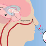 Alzheimer’s Disease and Oral Microbiome