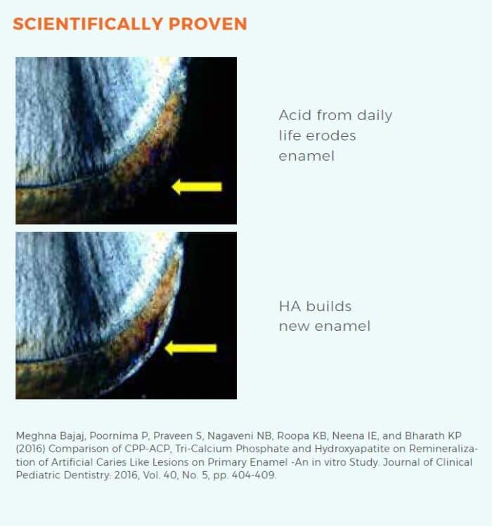 Polarized Microscope showing HAp Remineralization reviewed by Sunnyvale Functional Dentist Jen Chiang DDS