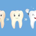 Tooth character whitening