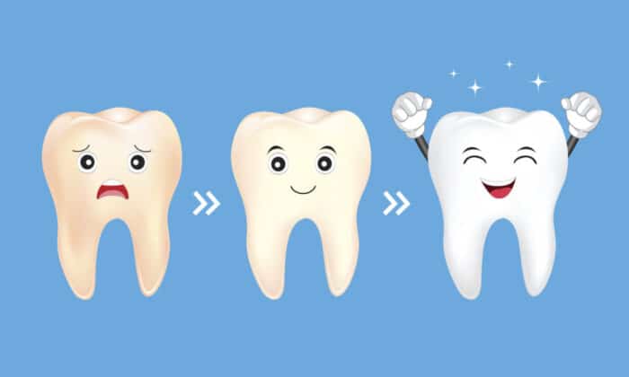 How to Brighten Your Smile by Sunnyvale Dentist Jennifer Chiang, DDS