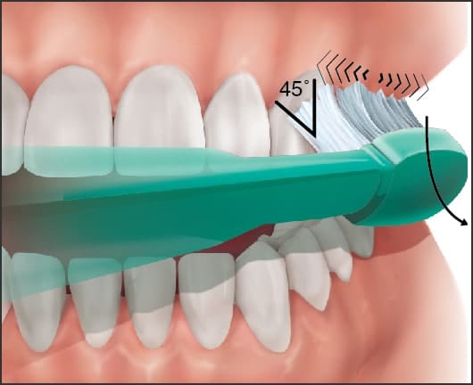 proper brushing technique - hold tooth brush at a 45 degree angle and brush the gum lines as well as the tooth service