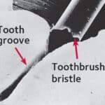 toothbrush-bristle-and-tooth-groove